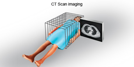cancer-treatemt-image