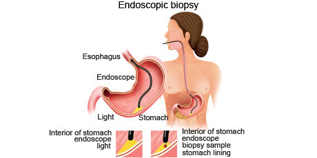 cancer-treatemt-image