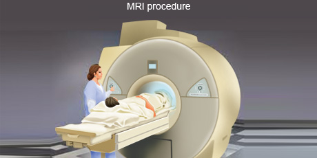 cancer-treatemt-image