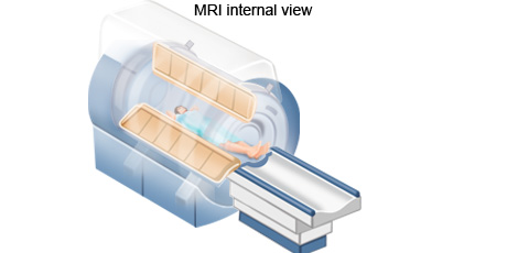 cancer-treatemt-image