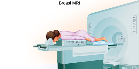 cancer-treatemt-image