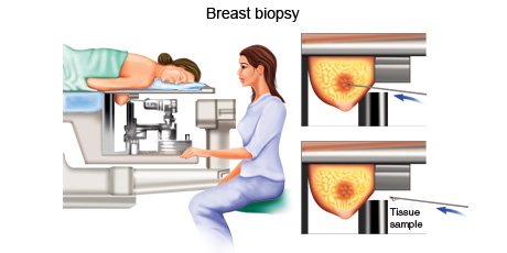 cancer-treatemt-image