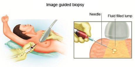 cancer-treatemt-image