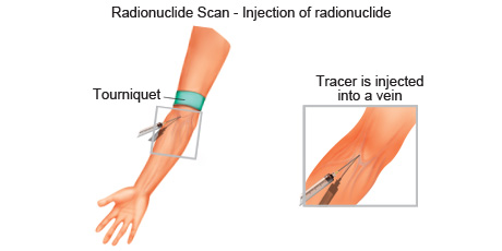 cancer-treatemt-image