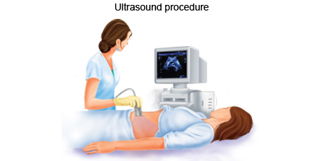 cancer-treatemt-image