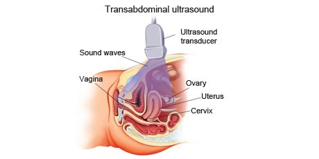 cancer-treatemt-image