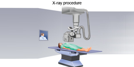 cancer-treatemt-image