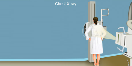 cancer-treatemt-image