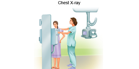 cancer-treatemt-image
