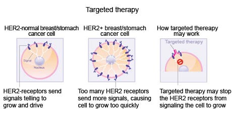 cancer-treatemt-image