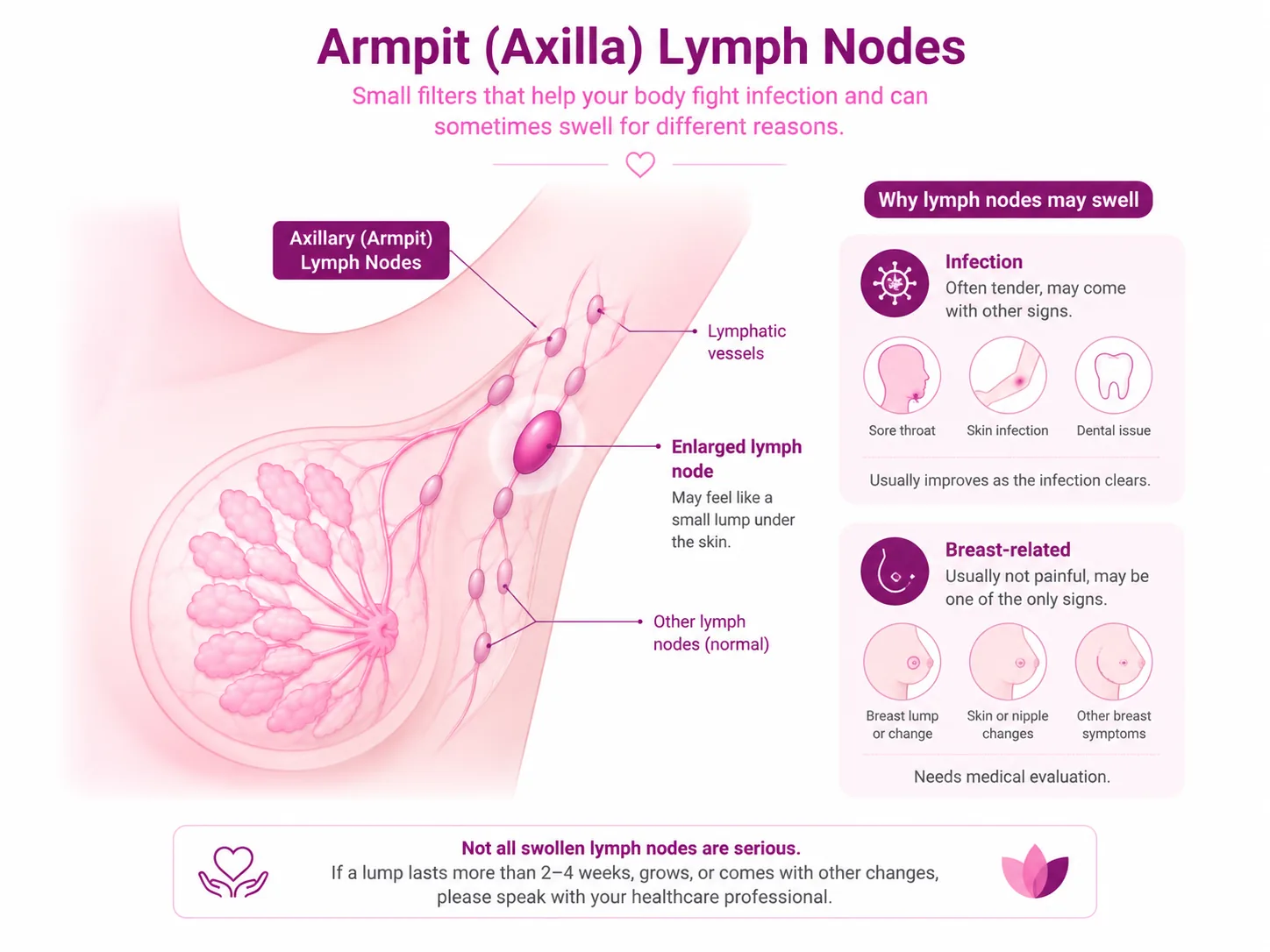 Diagram of the axilla (armpit) showing the chain of lymph nodes that drain the breast and arm, with one lymph node enlarged, and why nodes swell — infection versus breast-related causes