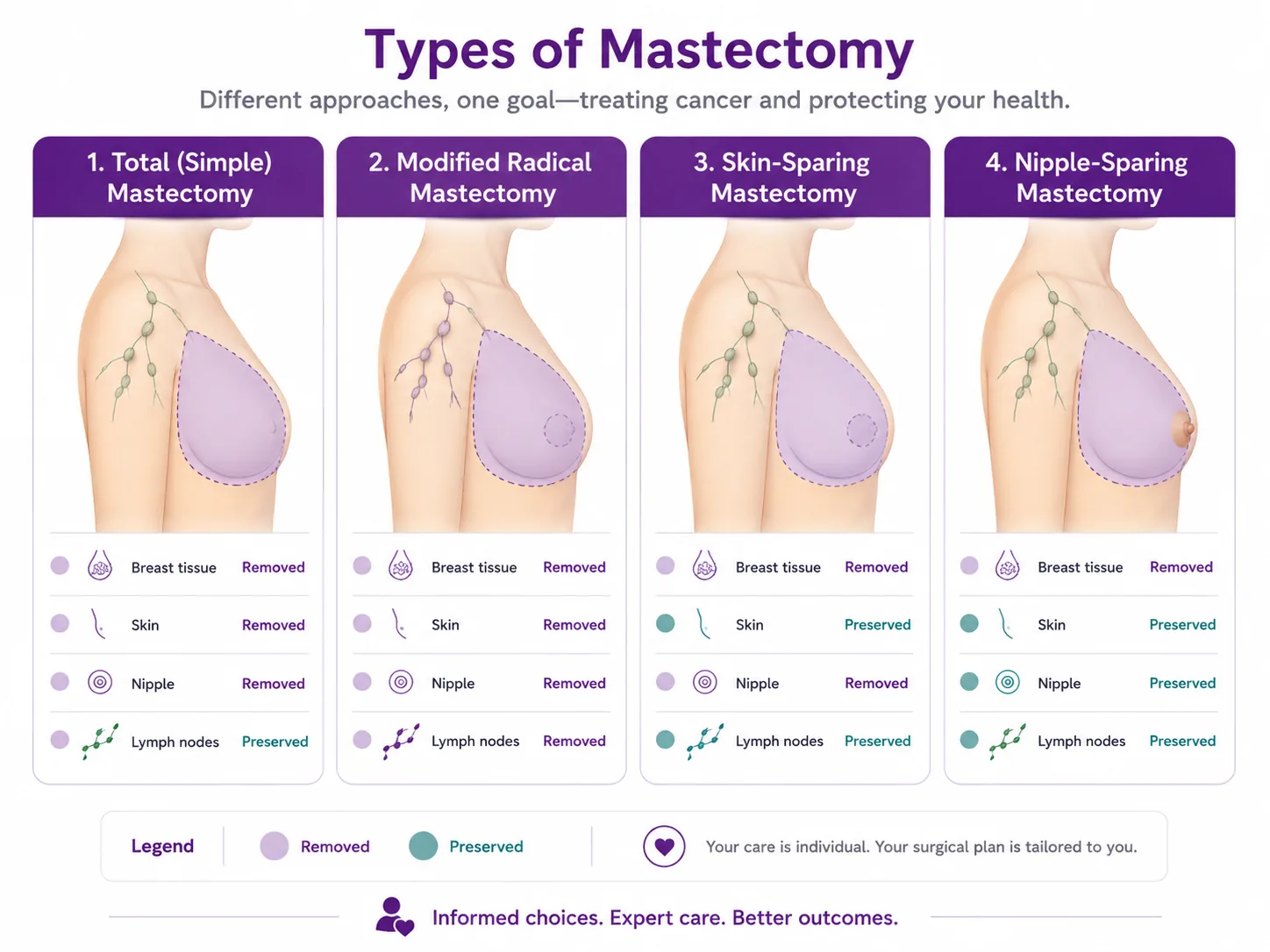 Comparison of mastectomy types — total (simple), modified radical, skin-sparing and nipple-sparing — showing which of breast tissue, skin, nipple and lymph nodes are removed or preserved, CION Cancer Clinics Hyderabad