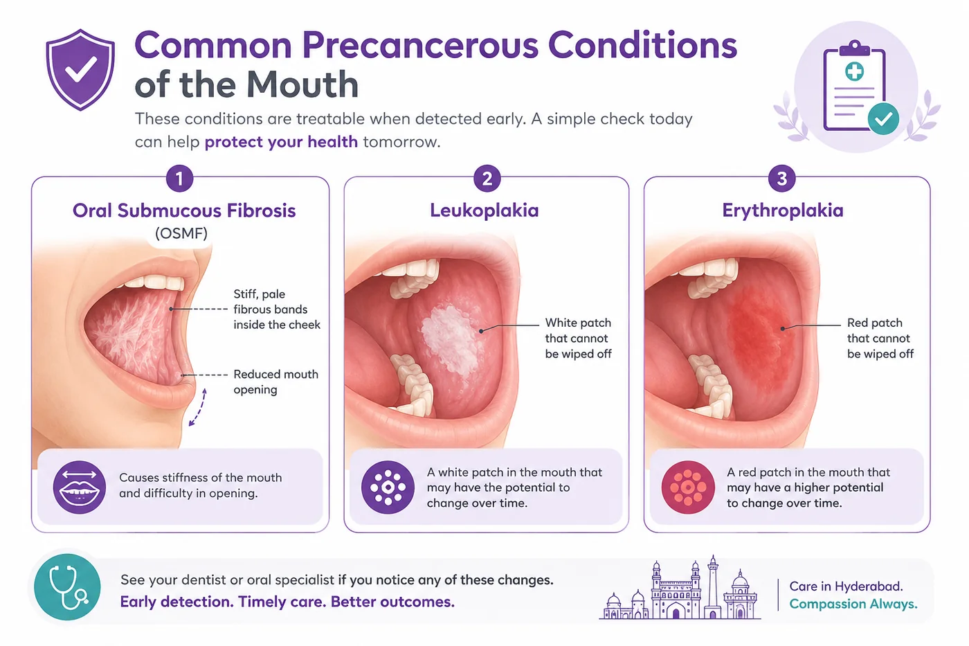 Common precancerous oral conditions — oral submucous fibrosis (OSMF), leukoplakia and erythroplakia