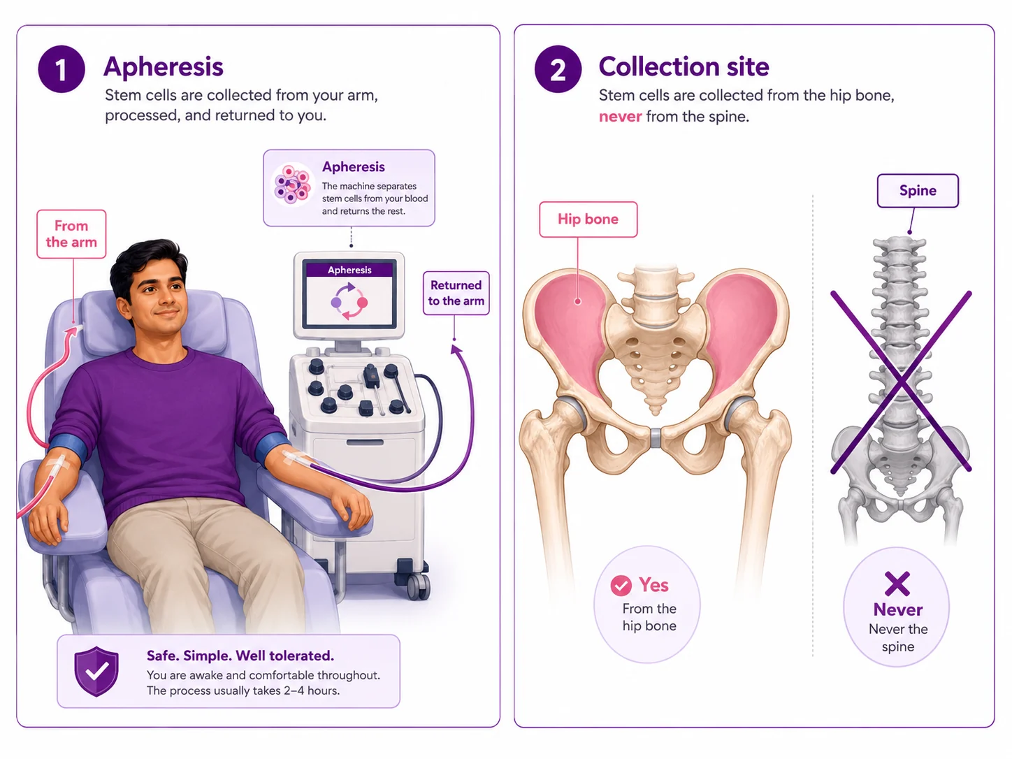 Diagram showing bone marrow stem cells are collected from the arm by apheresis or from the hip bone, never from the spine — CION Cancer Clinics, Hyderabad