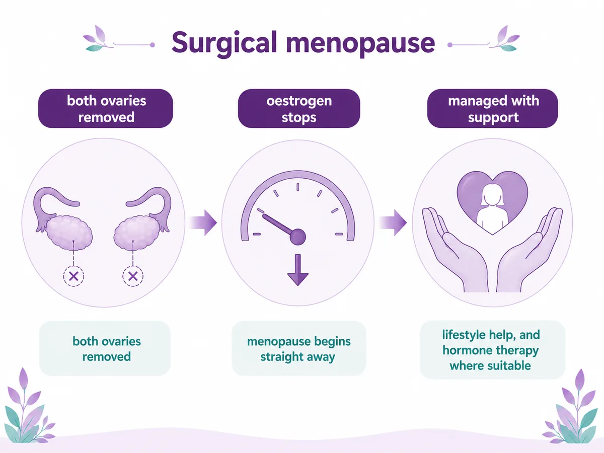Diagram explaining surgical menopause after a bilateral salpingo-oophorectomy — both ovaries removed, the body's oestrogen stops and menopause begins straight away, then it is managed with lifestyle support and hormone therapy where suitable