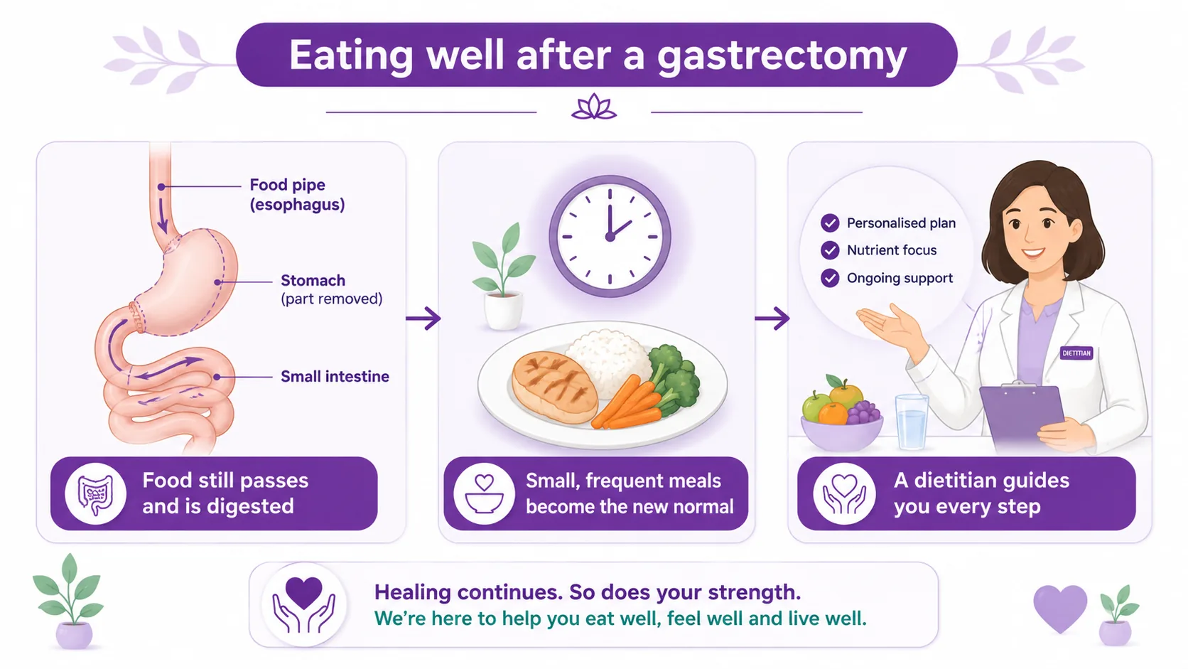 Infographic showing eating well after a gastrectomy — food still passes and is digested, small frequent meals become the new normal, and a dietitian guides you every step