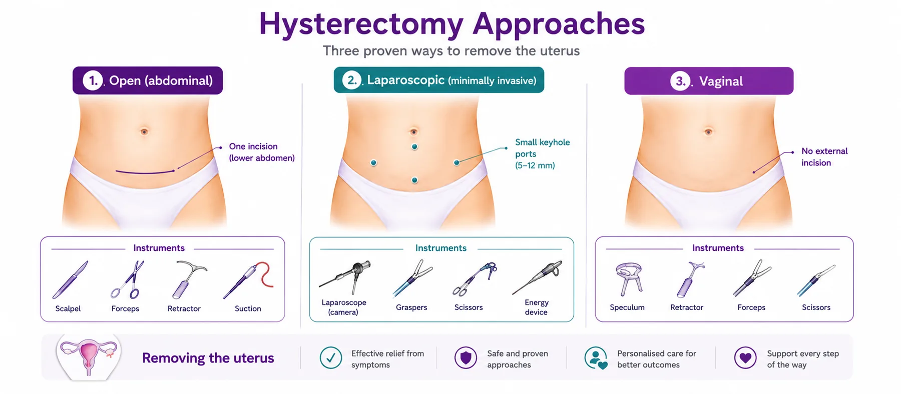 Hysterectomy approaches compared — open (abdominal), laparoscopic (minimally invasive) keyhole surgery, and vaginal surgery, with the instruments used for each