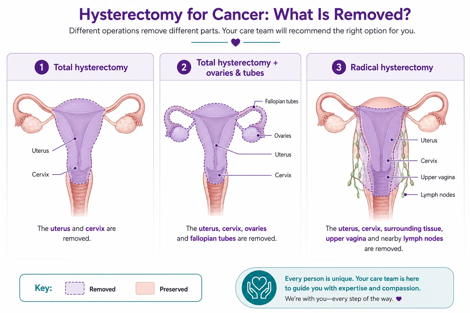 What is removed in a total hysterectomy, a total hysterectomy with ovaries and tubes, and a radical hysterectomy for gynaecological cancer
