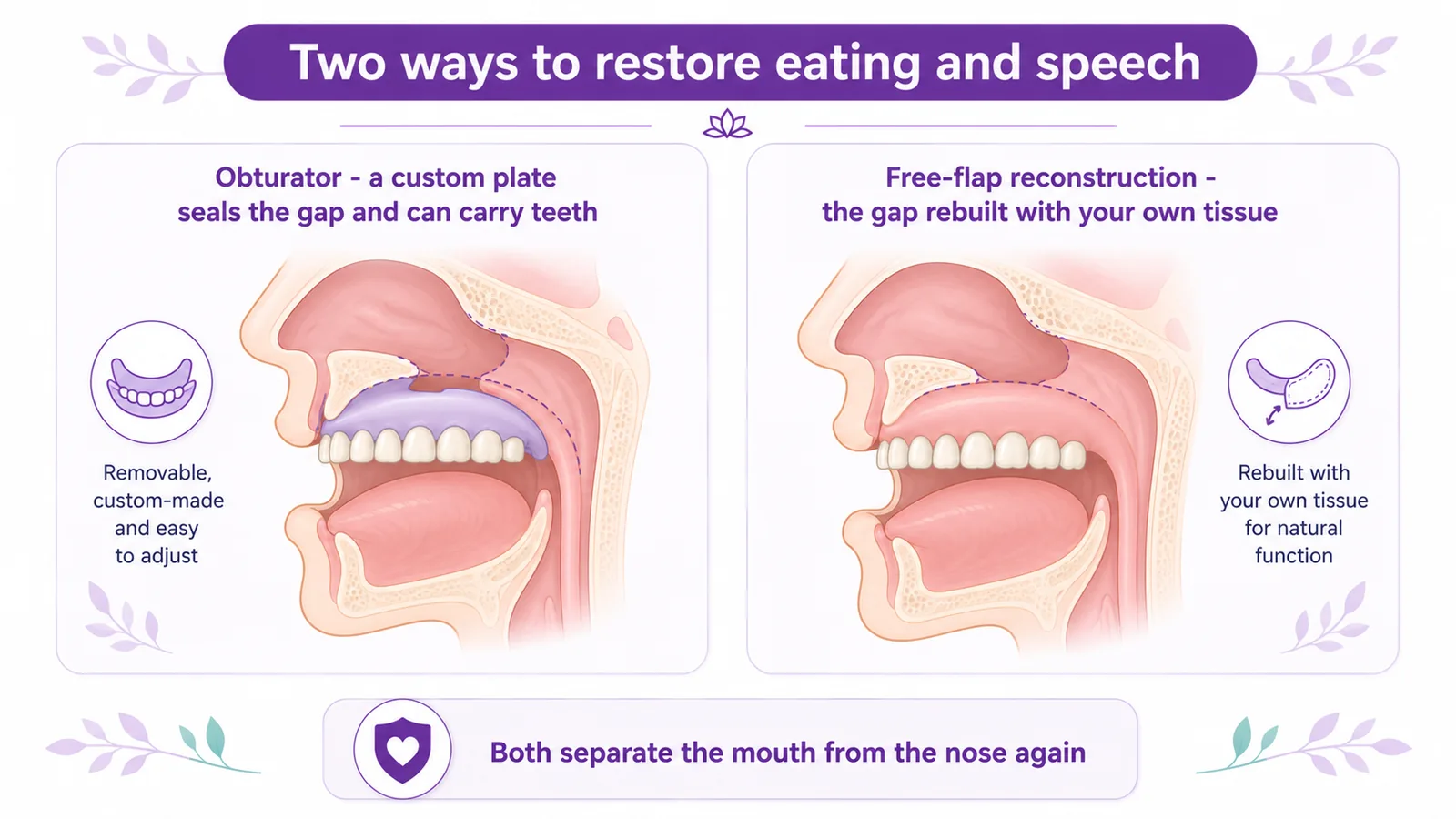 Diagram comparing an obturator (a custom plate that seals the gap and can carry teeth) and free-flap reconstruction (the gap rebuilt with your own tissue) to restore eating and speech after a maxillectomy, CION Cancer Clinics Hyderabad
