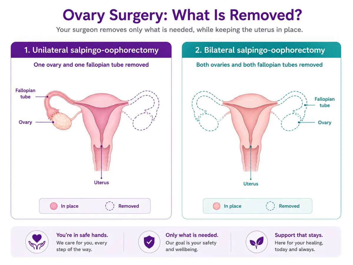 Unilateral versus bilateral salpingo-oophorectomy — a two-panel comparison showing removal of one ovary and one fallopian tube versus both ovaries and both fallopian tubes, with the uterus kept in place — CION Cancer Clinics Hyderabad
