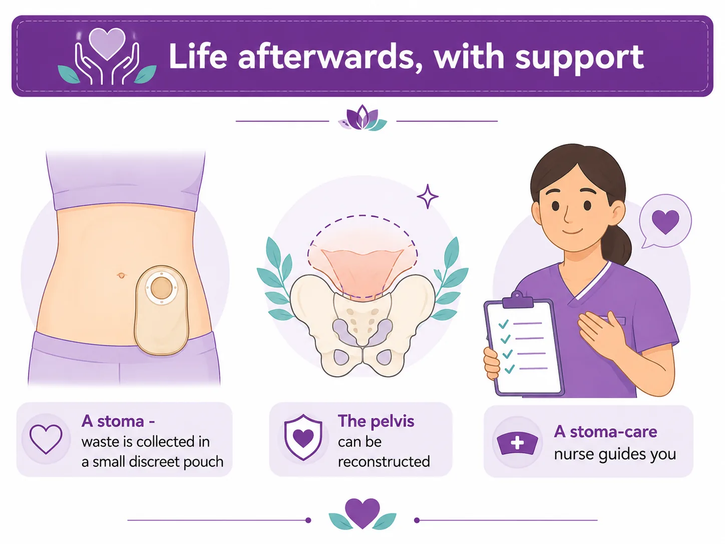 Diagram of life after a pelvic exenteration — a small discreet stoma pouch collecting waste, reconstruction of the pelvis, and a stoma-care nurse supporting the patient, CION Cancer Clinics Hyderabad