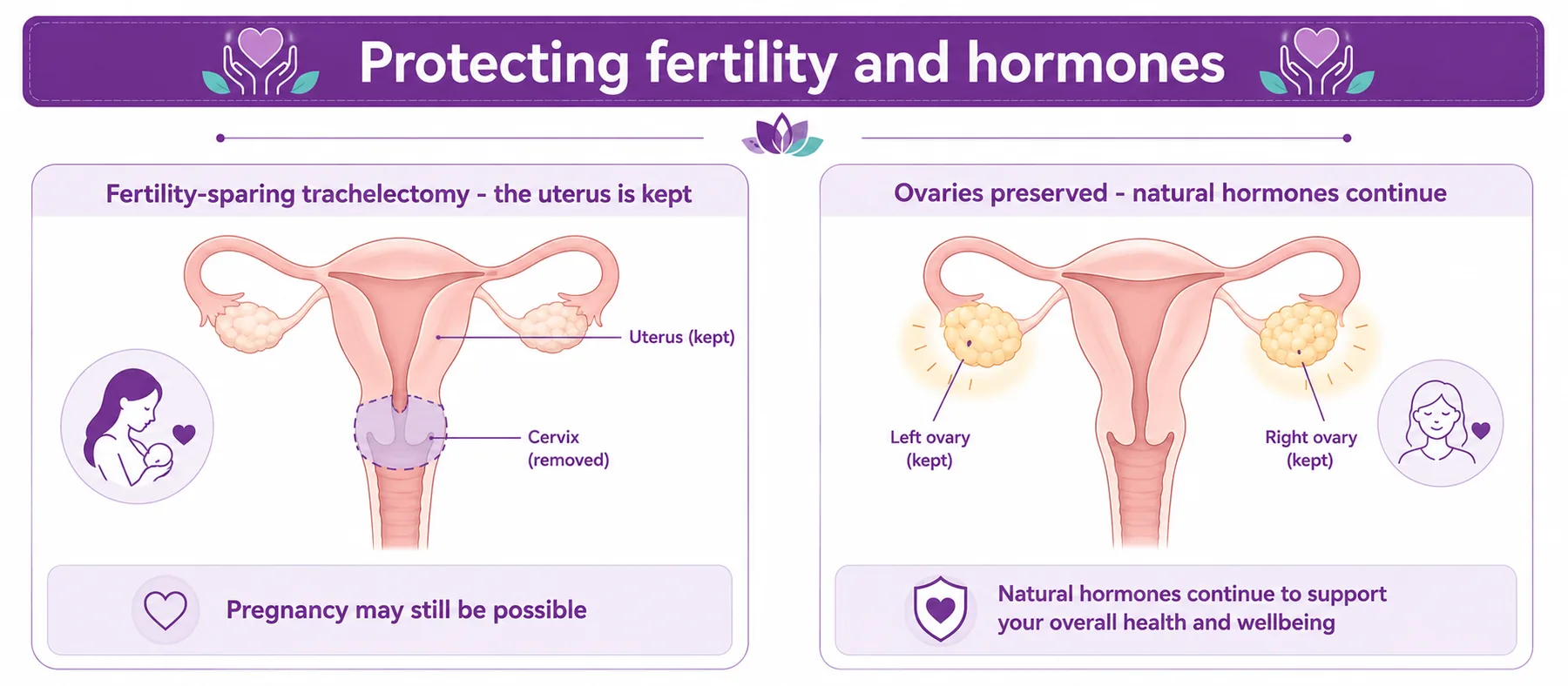 Diagram showing options to protect fertility and hormones — a fertility-sparing trachelectomy that keeps the uterus, and preserving the ovaries so natural hormones continue