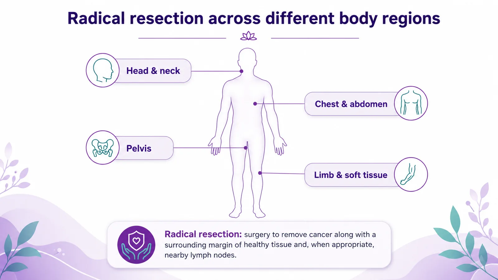 Body-region map of cancers treated by radical resection — head and neck, chest and abdomen, pelvis, and limb and soft tissue, CION Cancer Clinics Hyderabad