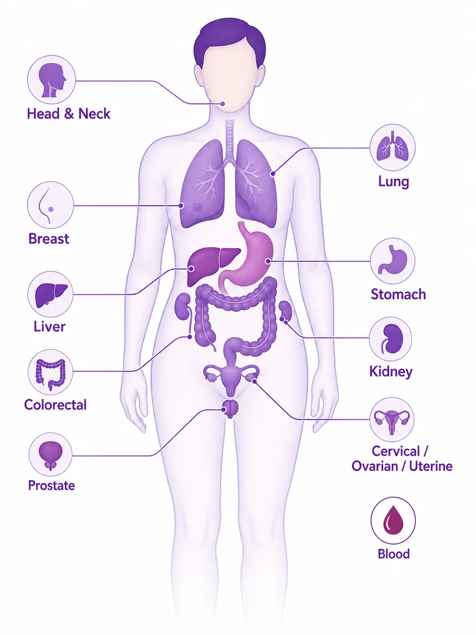 Types of cancer treated at CION — head & neck, lung, breast, stomach, liver, kidney, colorectal, prostate, cervical, ovarian, uterine and blood cancers