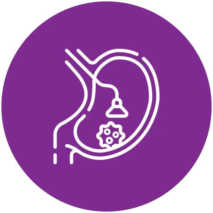 Biopsy test at Affordable Cost In Hyderabad Cion Cancer Clinics