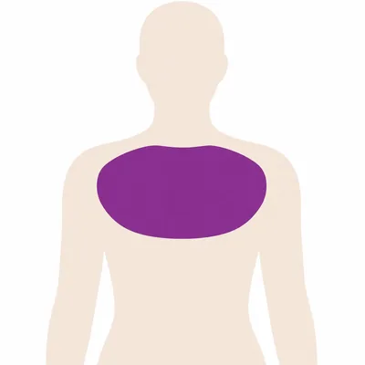 A body outline with the breast and chest wall marked, one of the sites a core needle biopsy is taken from