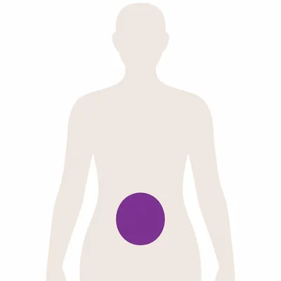 A body outline with a deep site inside the abdomen marked, where a scan is needed to place the needle