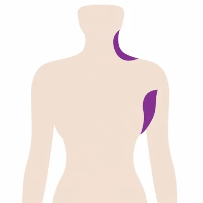 A body outline with the glands of the neck and the armpit marked