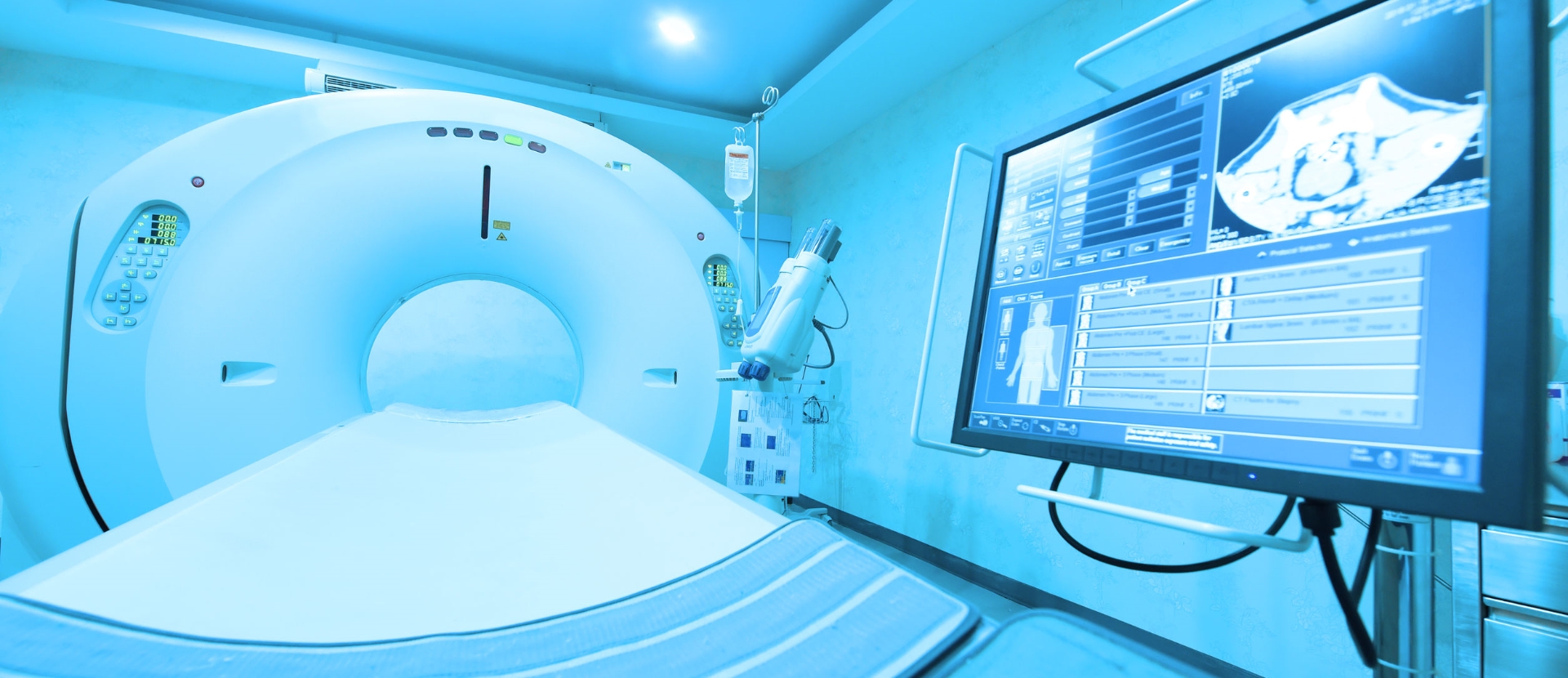 Bone scan in Hyderabad | Bone Scan Cost in Hyderabad