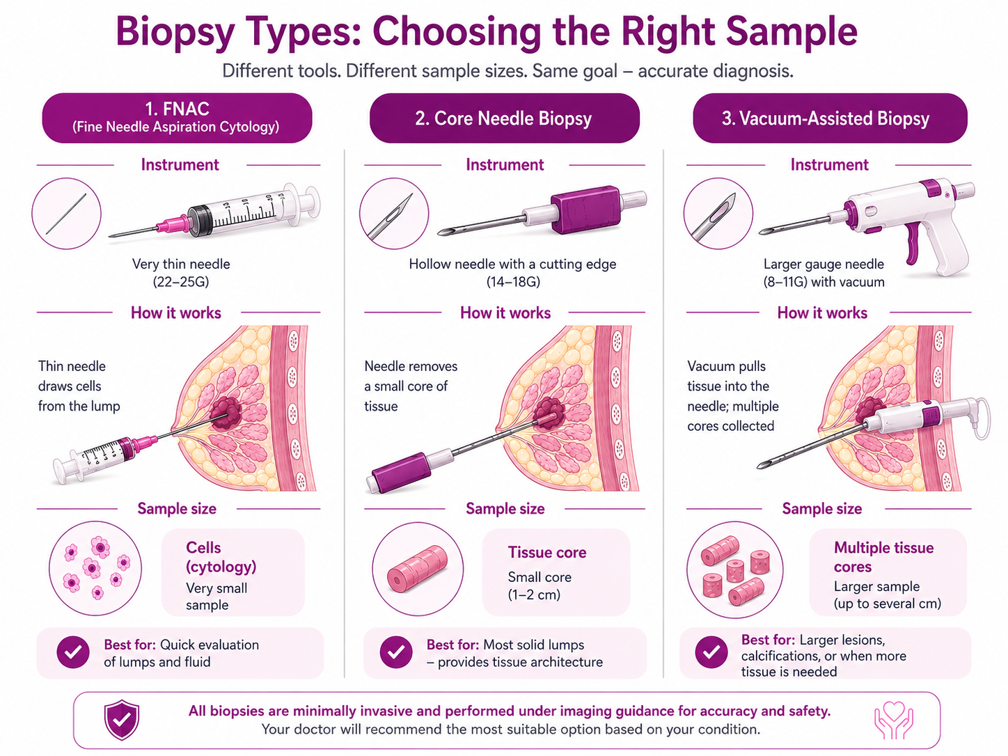 The three main breast biopsy types compared — FNAC (fine needle aspiration cytology) using a very thin 22 to 25G needle to draw cells, core needle biopsy using a 14 to 18G hollow cutting needle to take a small tissue core, and vacuum-assisted biopsy using an 8 to 11G needle with vacuum to collect multiple cores — with the instrument, how it works and sample size for each.