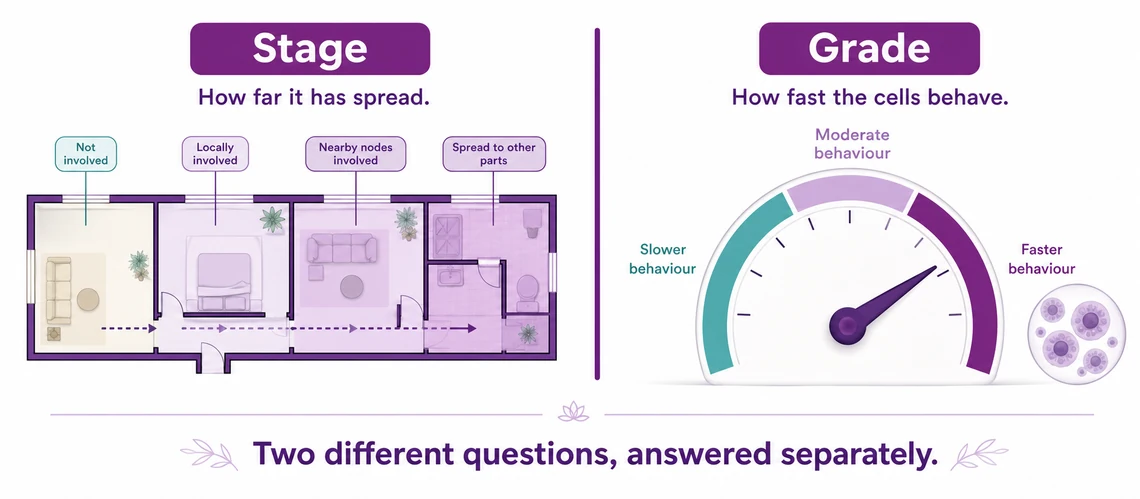 The difference between breast cancer stage and grade explained - CION Cancer Clinics