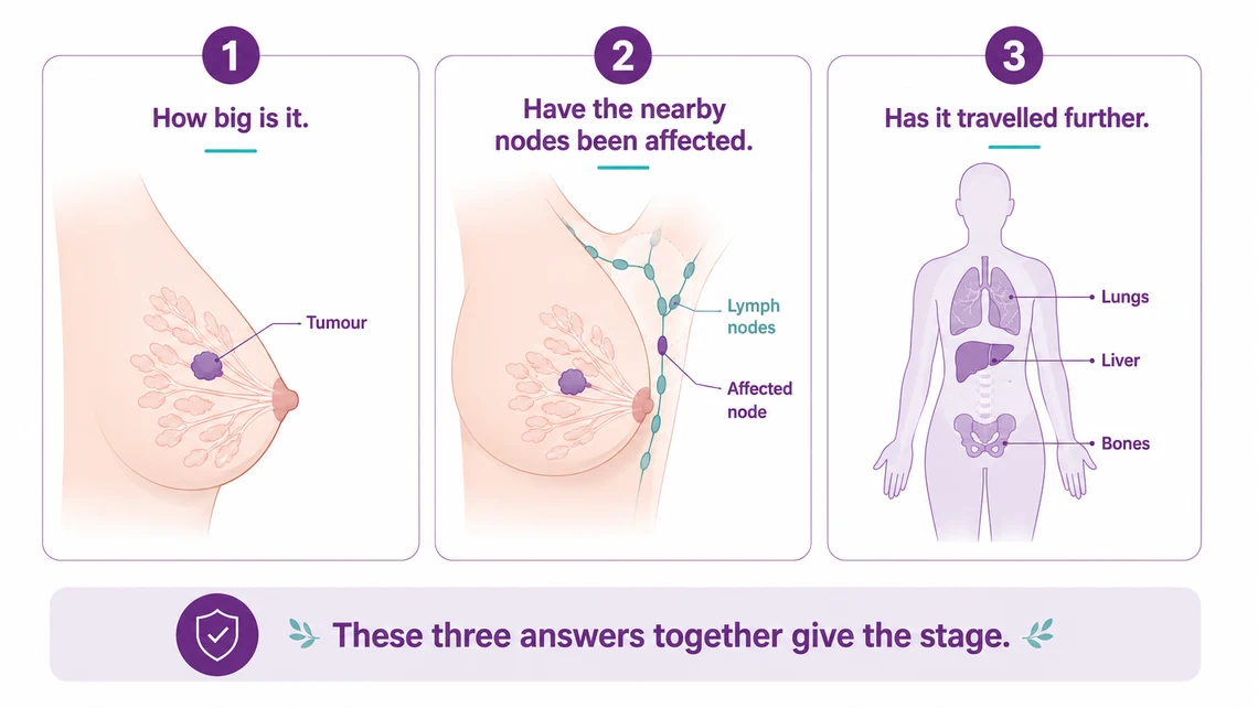 The three questions behind breast cancer staging - size, nodes and spread - CION Cancer Clinics