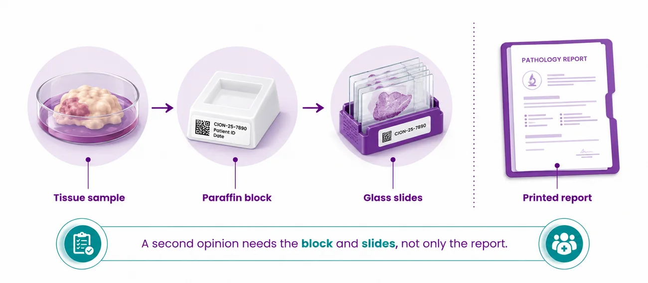 The paraffin block and glass slides a laboratory keeps after a breast biopsy - CION Cancer Clinics