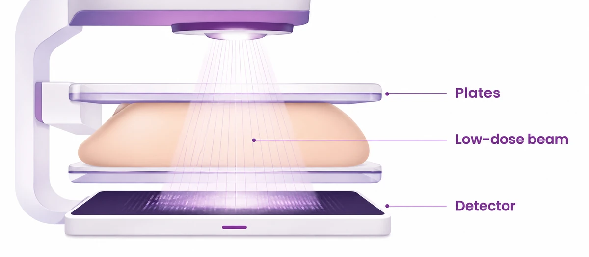 How a mammogram forms an image using low-dose X-ray between two plates - CION Cancer Clinics