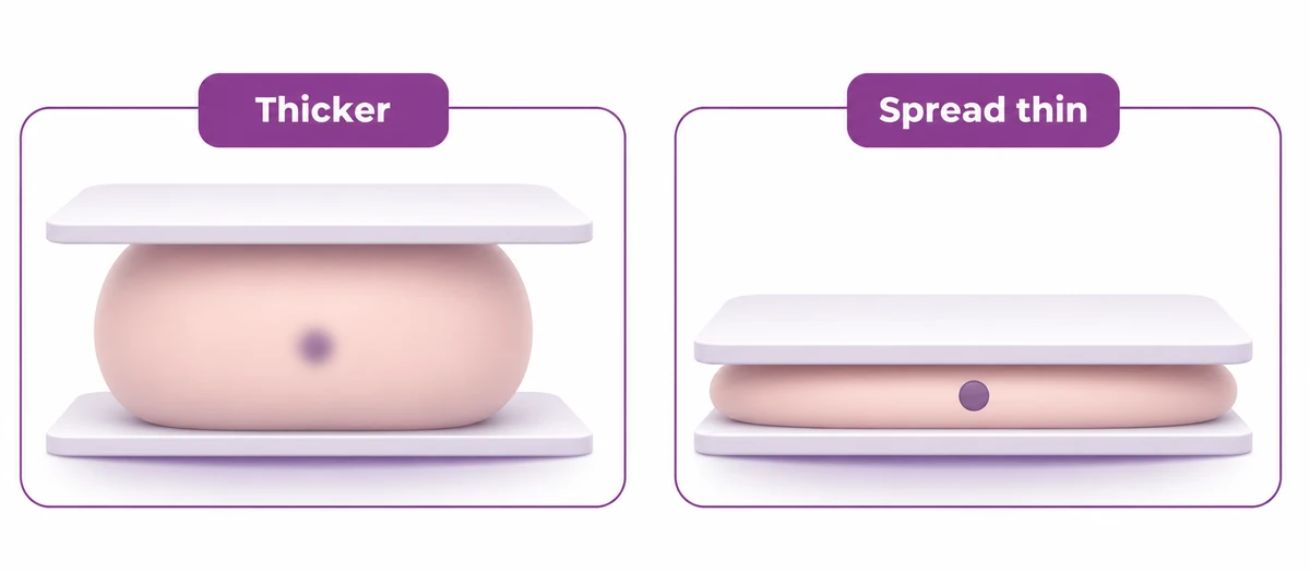 Why a mammogram compresses the tissue - spreading it thinner makes a small finding visible - CION Cancer Clinics
