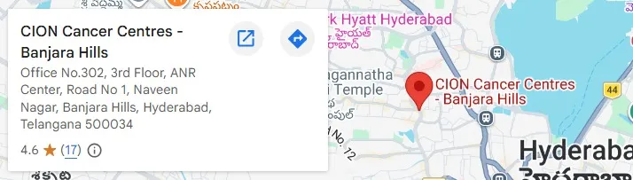 CION Cancer Clinic at L.B. Nagar