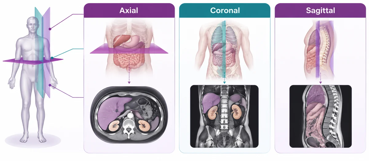 Diagram of the three MRI viewing planes - axial, coronal and sagittal - CION Cancer Clinics