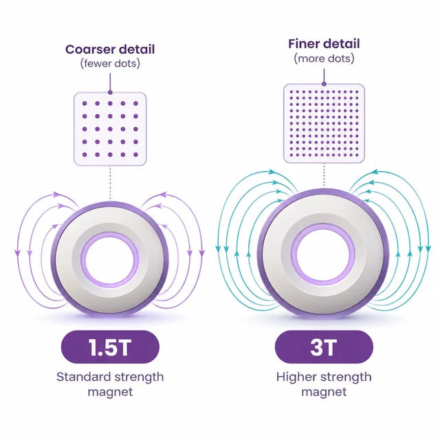 Diagram comparing 1.5T and 3T MRI scanner strength and image detail - CION Cancer Clinics