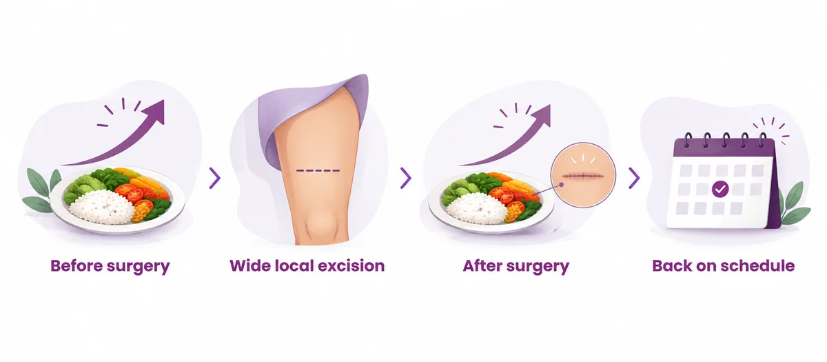 Diagram of protein needs before and after sarcoma surgery - CION Cancer Clinics