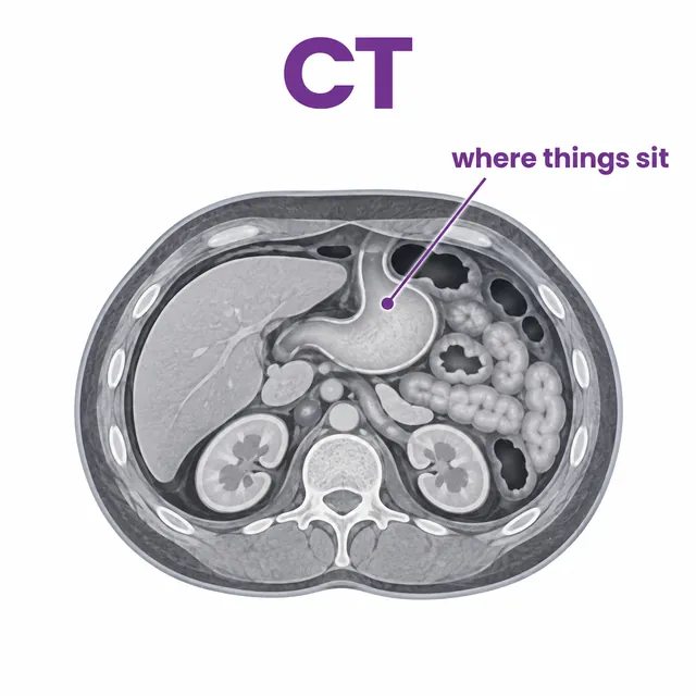 Diagram of a CT scan showing the anatomy of the body in cross-section - CION Cancer Clinics