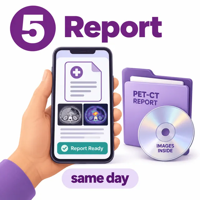 Illustration of a PET-CT scan report arriving on a phone the same day - CION Cancer Clinics