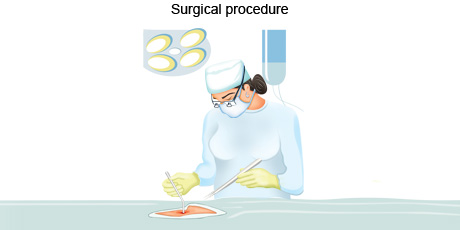 Surgery1