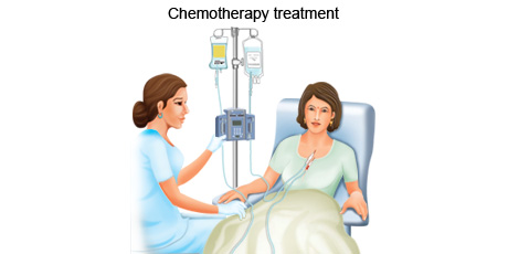 Chemo2