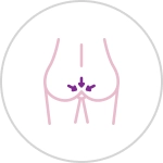 Anal Surgery