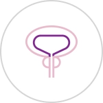 uterus surgery