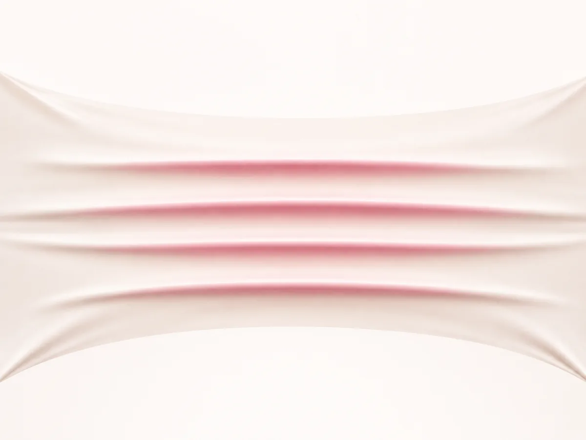 An illustration of firm cords forming in tissue